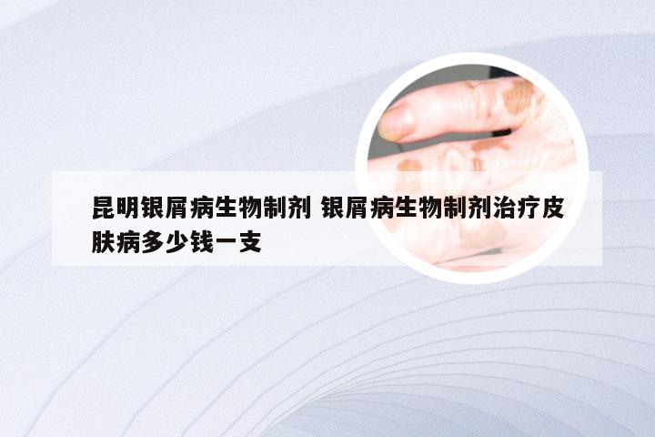 昆明银屑病生物制剂 银屑病生物制剂治疗皮肤病多少钱一支