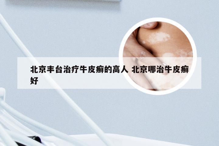 北京丰台治疗牛皮癣的高人 北京哪治牛皮癣好