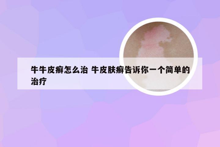 牛牛皮癣怎么治 牛皮肤癣告诉你一个简单的治疗