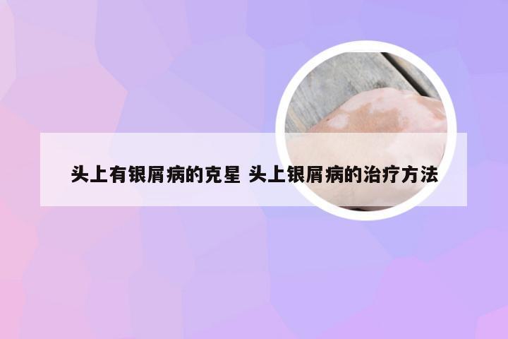 头上有银屑病的克星 头上银屑病的治疗方法