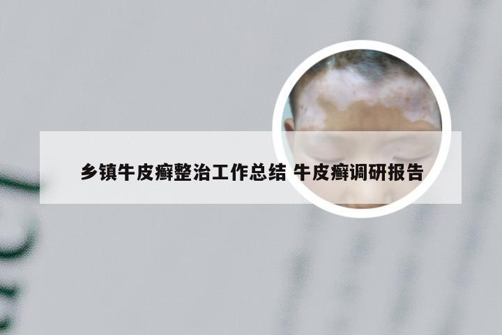 乡镇牛皮癣整治工作总结 牛皮癣调研报告