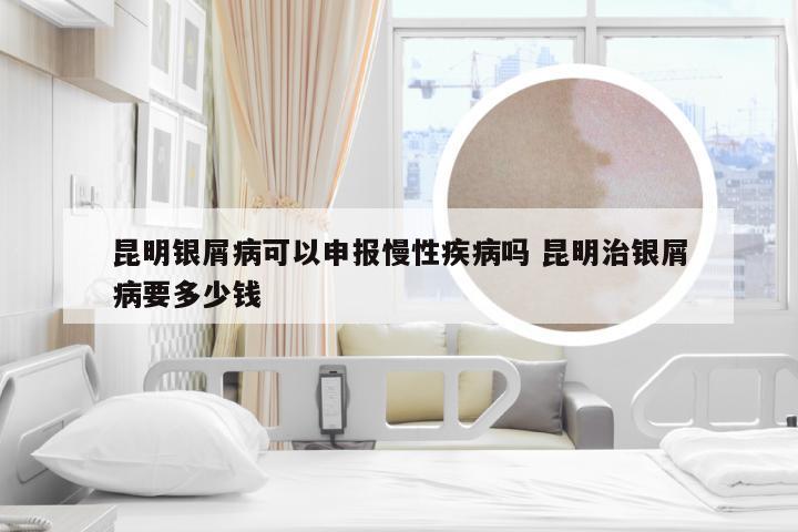 昆明银屑病可以申报慢性疾病吗 昆明治银屑病要多少钱