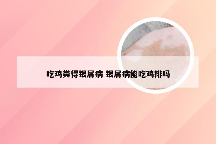 吃鸡粪得银屑病 银屑病能吃鸡排吗