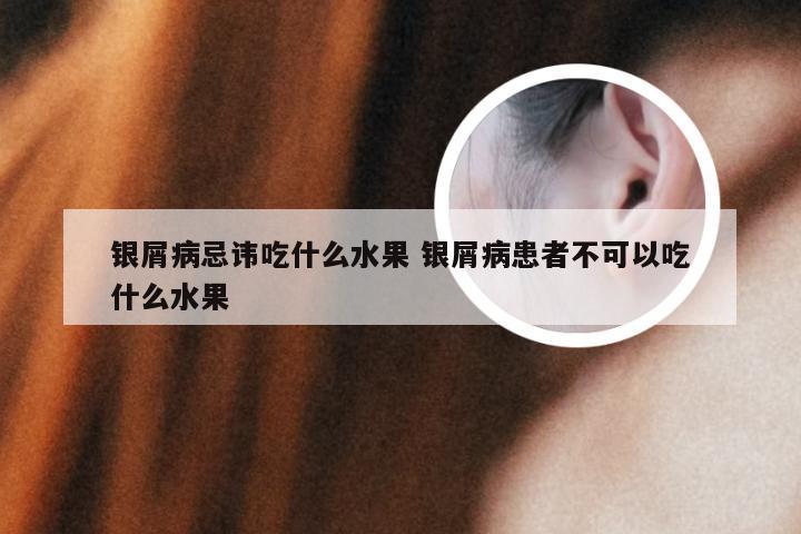 银屑病忌讳吃什么水果 银屑病患者不可以吃什么水果