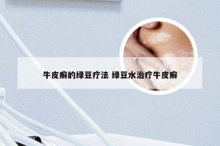 牛皮癣的绿豆疗法 绿豆水治疗牛皮癣