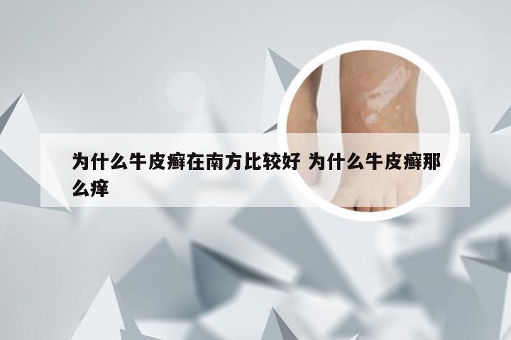 为什么牛皮癣在南方比较好 为什么牛皮癣那么痒