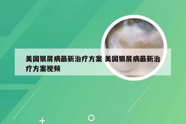 美国银屑病最新治疗方案 美国银屑病最新治疗方案视频