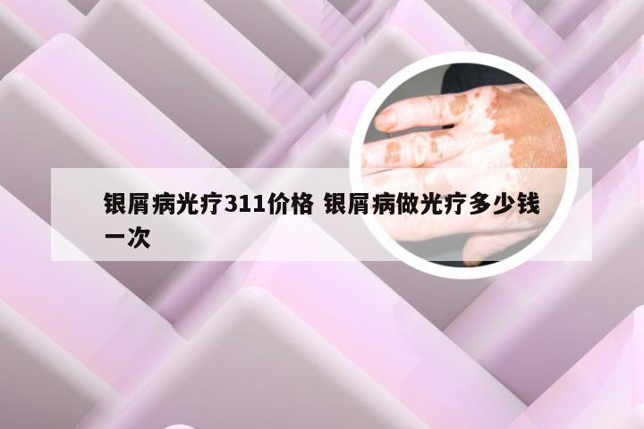 银屑病光疗311价格 银屑病做光疗多少钱一次