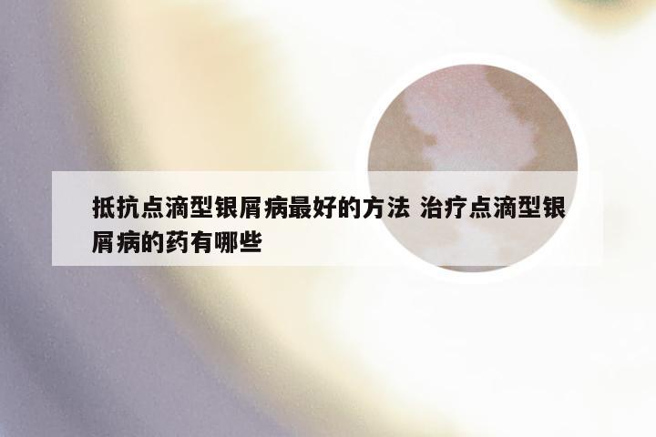 抵抗点滴型银屑病最好的方法 治疗点滴型银屑病的药有哪些