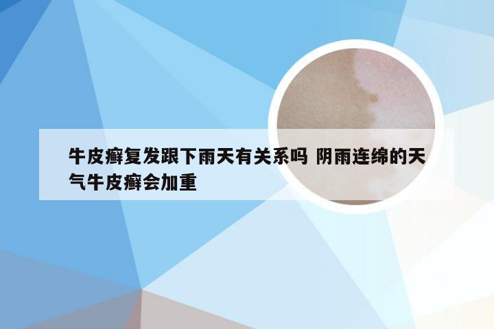 牛皮癣复发跟下雨天有关系吗 阴雨连绵的天气牛皮癣会加重
