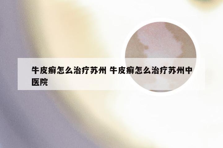 牛皮癣怎么治疗苏州 牛皮癣怎么治疗苏州中医院