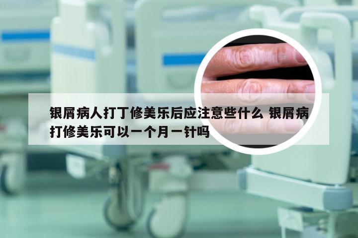 银屑病人打丁修美乐后应注意些什么 银屑病打修美乐可以一个月一针吗