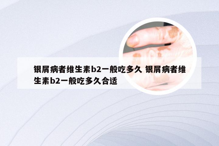 银屑病者维生素b2一般吃多久 银屑病者维生素b2一般吃多久合适