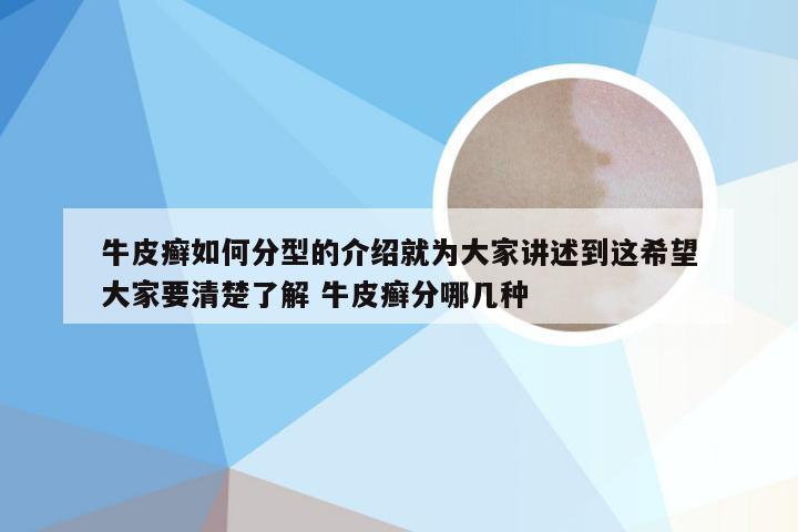 牛皮癣如何分型的介绍就为大家讲述到这希望大家要清楚了解 牛皮癣分哪几种