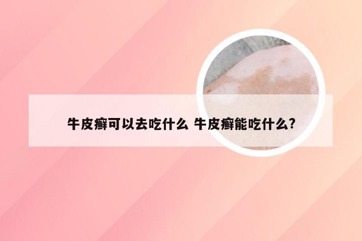 牛皮癣可以去吃什么 牛皮癣能吃什么?