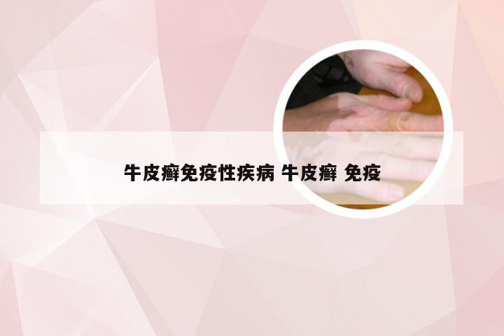 牛皮癣免疫性疾病 牛皮癣 免疫