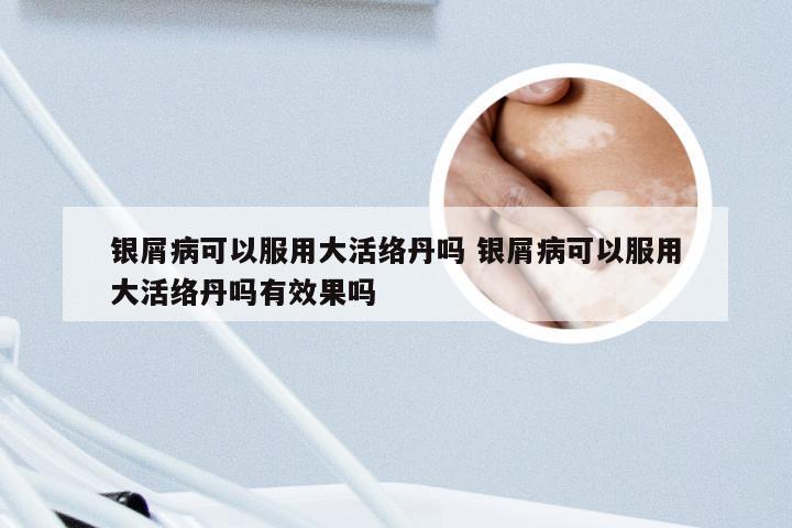 银屑病可以服用大活络丹吗 银屑病可以服用大活络丹吗有效果吗