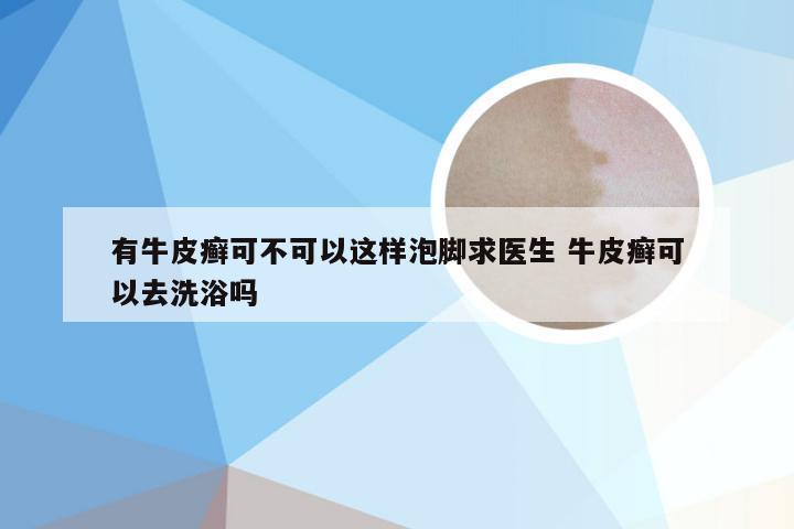 有牛皮癣可不可以这样泡脚求医生 牛皮癣可以去洗浴吗
