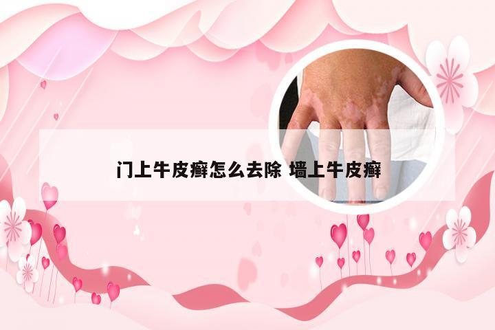门上牛皮癣怎么去除 墙上牛皮癣