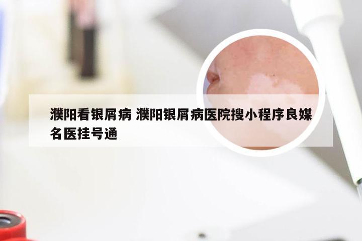 濮阳看银屑病 濮阳银屑病医院搜小程序良媒名医挂号通