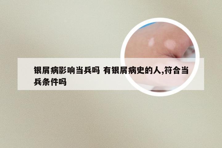 银屑病影响当兵吗 有银屑病史的人,符合当兵条件吗