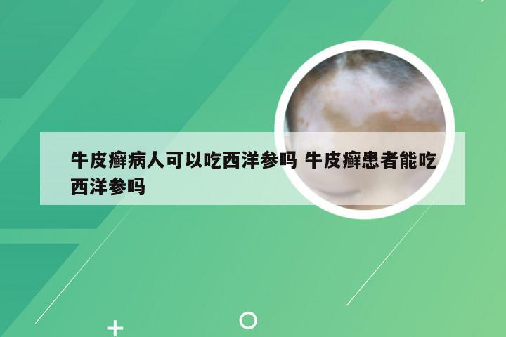 牛皮癣病人可以吃西洋参吗 牛皮癣患者能吃西洋参吗