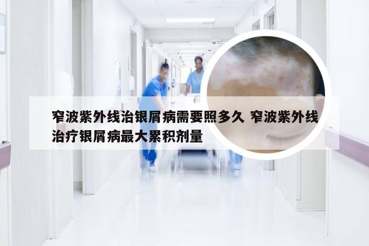 窄波紫外线治银屑病需要照多久 窄波紫外线治疗银屑病最大累积剂量