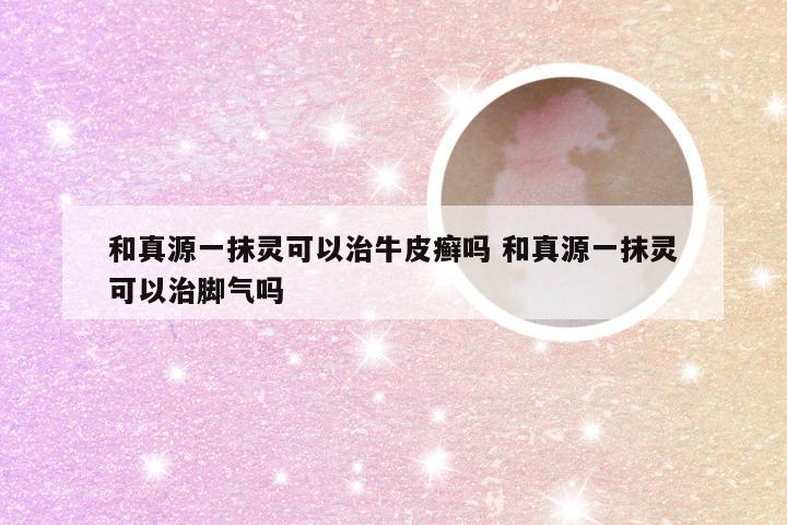 和真源一抹灵可以治牛皮癣吗 和真源一抹灵可以治脚气吗