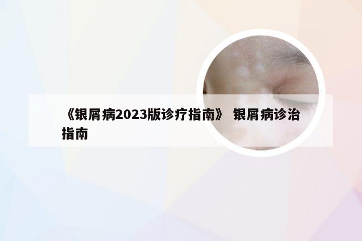 《银屑病2023版诊疗指南》 银屑病诊治指南