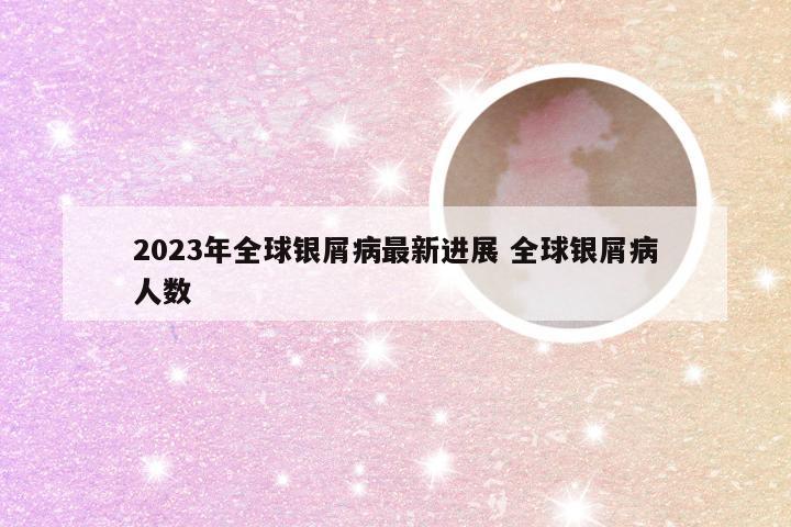 2023年全球银屑病最新进展 全球银屑病人数