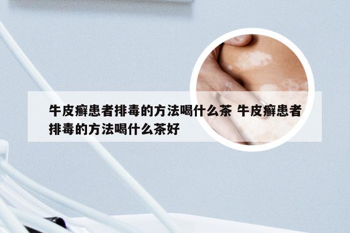 牛皮癣患者排毒的方法喝什么茶 牛皮癣患者排毒的方法喝什么茶好
