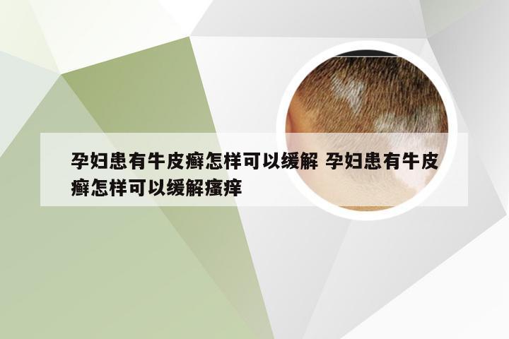 孕妇患有牛皮癣怎样可以缓解 孕妇患有牛皮癣怎样可以缓解瘙痒