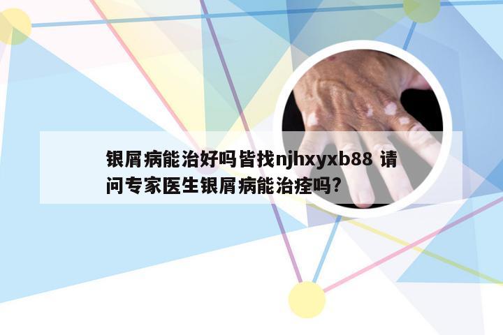 银屑病能治好吗皆找njhxyxb88 请问专家医生银屑病能治痊吗?