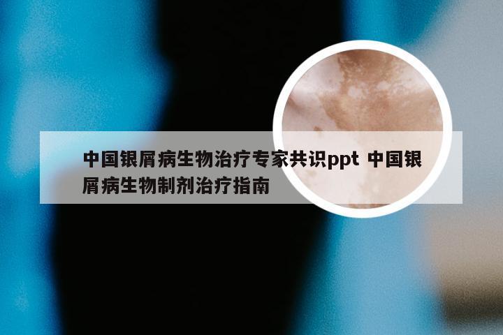 中国银屑病生物治疗专家共识ppt 中国银屑病生物制剂治疗指南