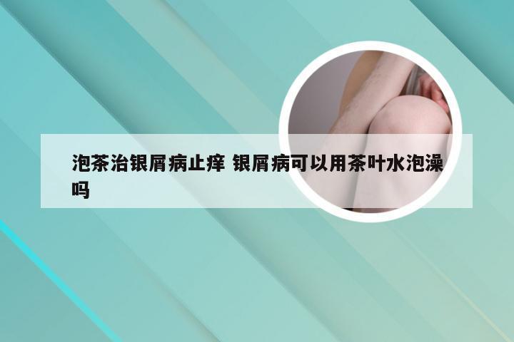 泡茶治银屑病止痒 银屑病可以用茶叶水泡澡吗
