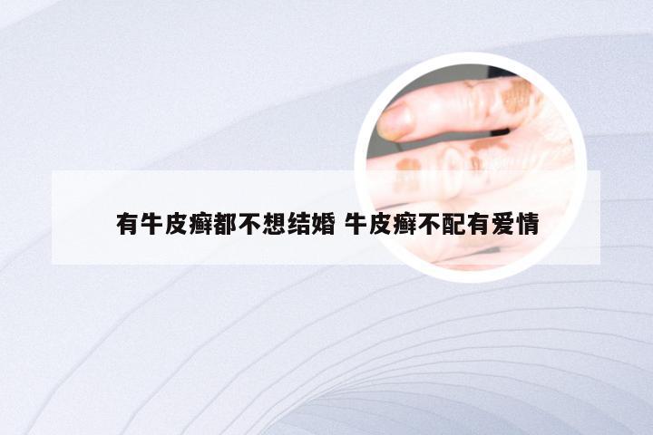 有牛皮癣都不想结婚 牛皮癣不配有爱情