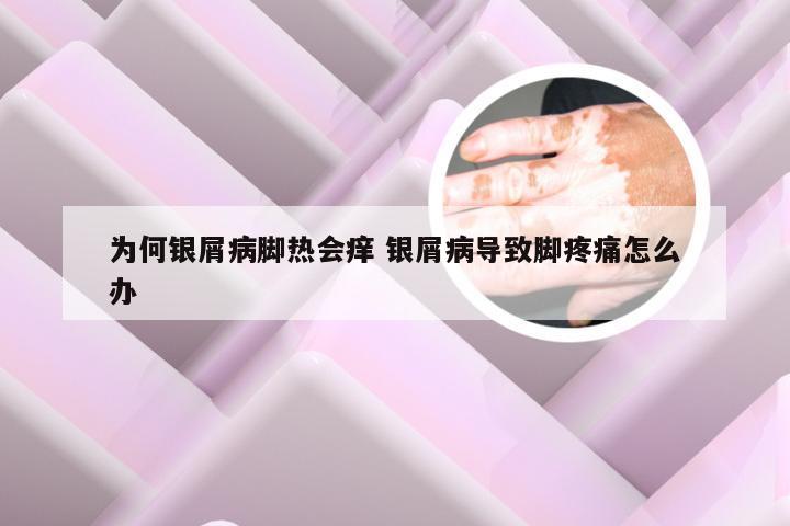 为何银屑病脚热会痒 银屑病导致脚疼痛怎么办
