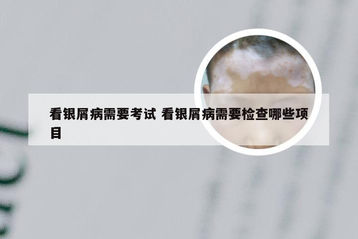 看银屑病需要考试 看银屑病需要检查哪些项目