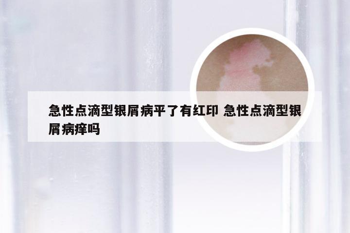 急性点滴型银屑病平了有红印 急性点滴型银屑病痒吗