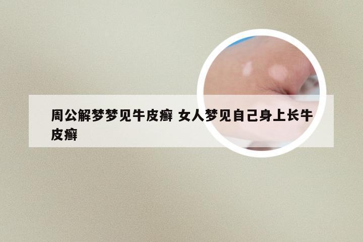 周公解梦梦见牛皮癣 女人梦见自己身上长牛皮癣