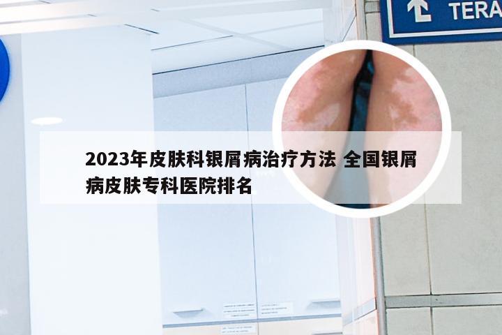 2023年皮肤科银屑病治疗方法 全国银屑病皮肤专科医院排名