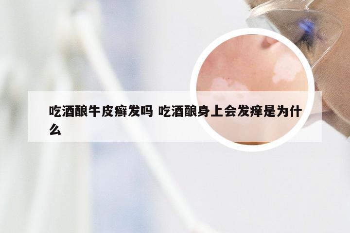吃酒酿牛皮癣发吗 吃酒酿身上会发痒是为什么