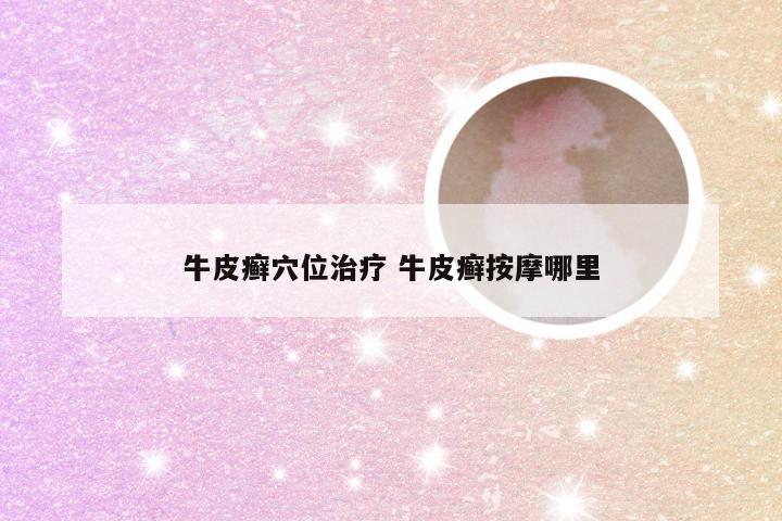 牛皮癣穴位治疗 牛皮癣按摩哪里