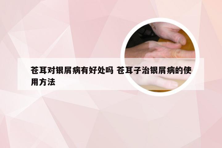 苍耳对银屑病有好处吗 苍耳子治银屑病的使用方法