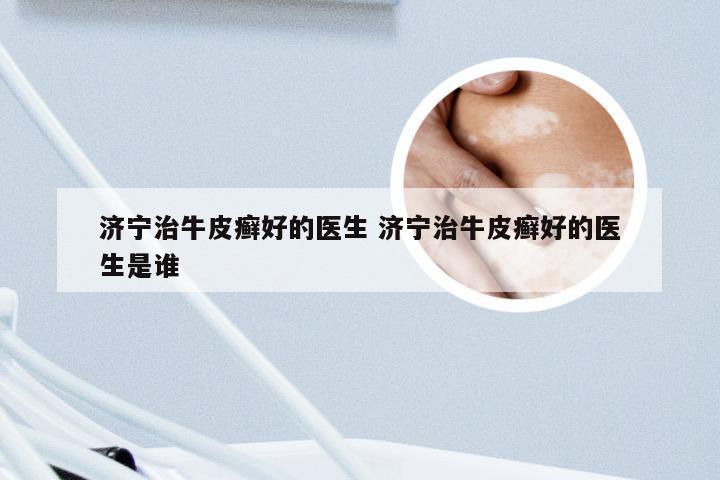 济宁治牛皮癣好的医生 济宁治牛皮癣好的医生是谁