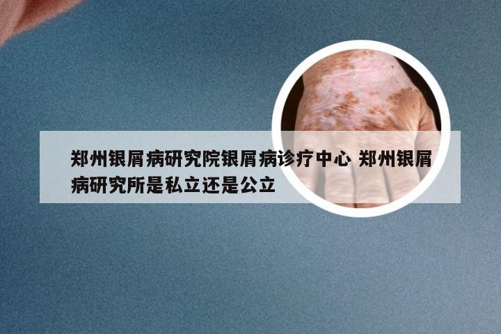郑州银屑病研究院银屑病诊疗中心 郑州银屑病研究所是私立还是公立