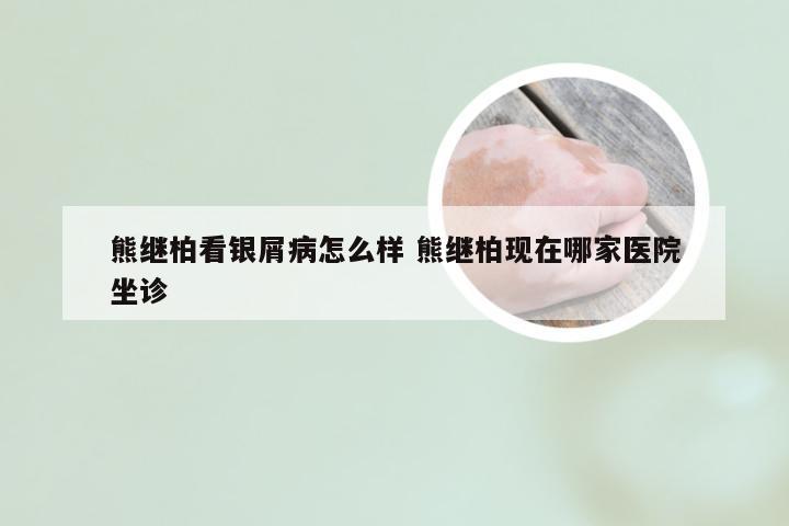 熊继柏看银屑病怎么样 熊继柏现在哪家医院坐诊