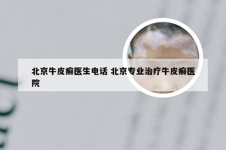 北京牛皮癣医生电话 北京专业治疗牛皮癣医院