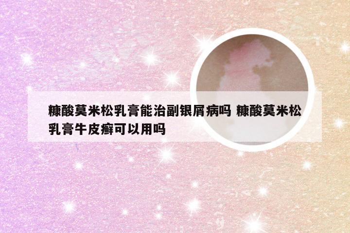 糠酸莫米松乳膏能治副银屑病吗 糠酸莫米松乳膏牛皮癣可以用吗