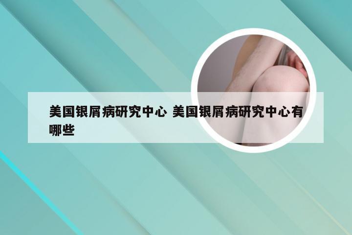 美国银屑病研究中心 美国银屑病研究中心有哪些